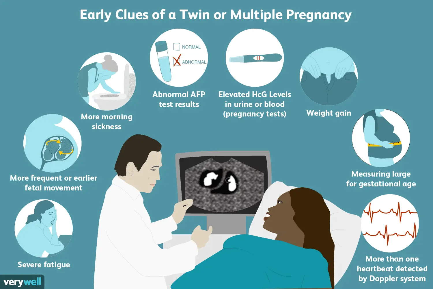 Signs and Symptoms of a Twin or Multiple Pregnancy