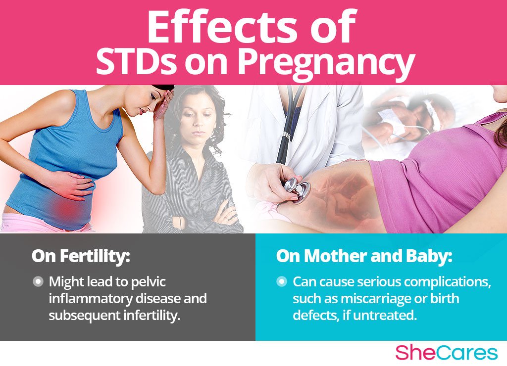 STDs and Getting Pregnant