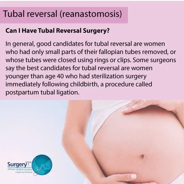 The 25+ best Pregnancy after tubal ligation ideas on Pinterest ...