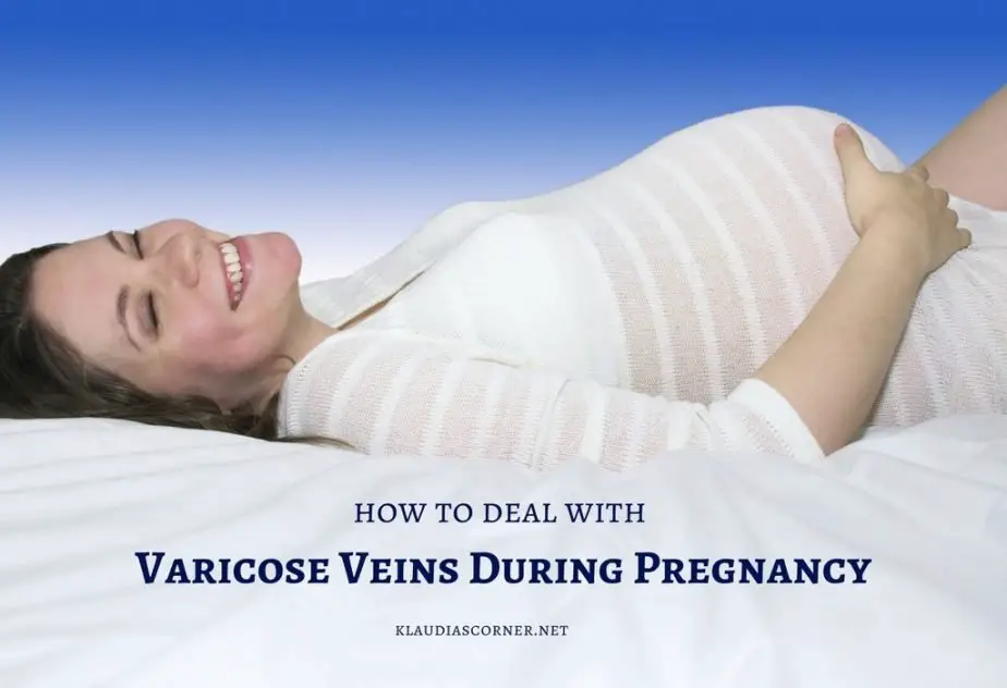 The Best Treatment For Varicose Veins During Pregnancy