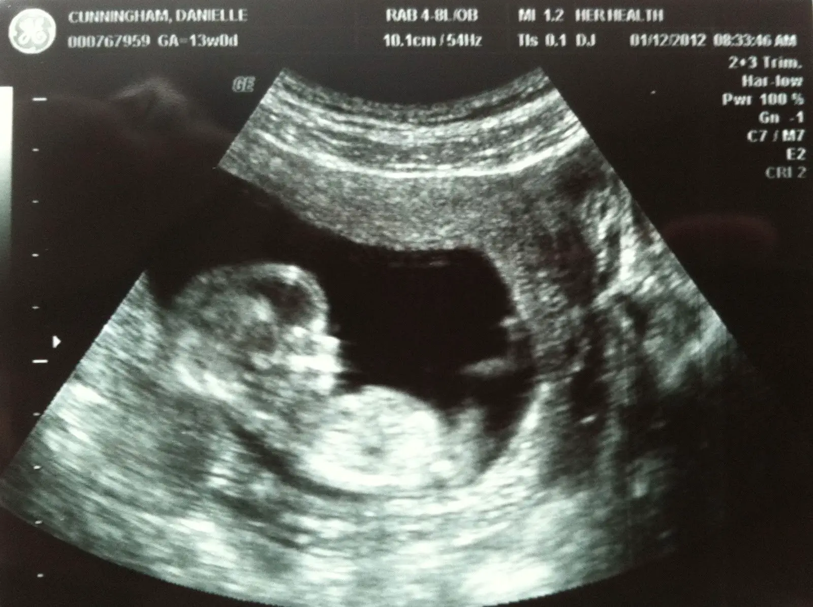 Travis &  Danielle: 13 week ultrasound