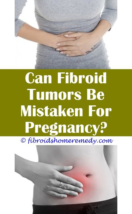 Trying To Get Pregnant With Fibroids