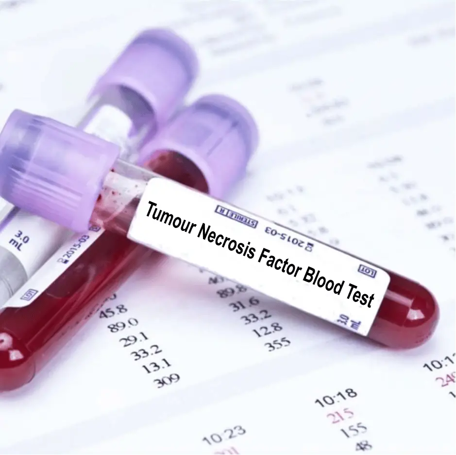 Tumour Necrosis Factor Blood Test