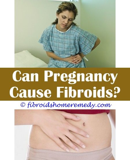 Uterine Fibroids Youtube