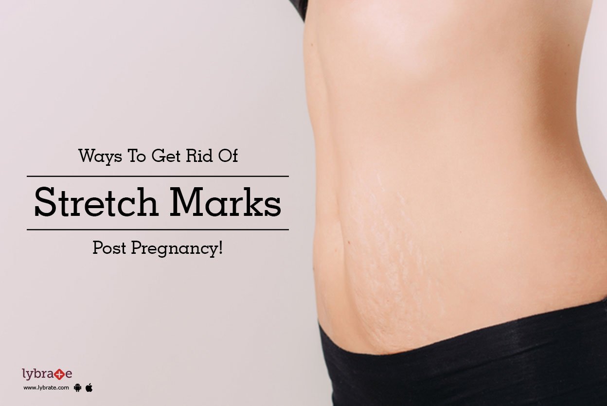 Ways To Get Rid Of Stretch Marks Post Pregnancy!