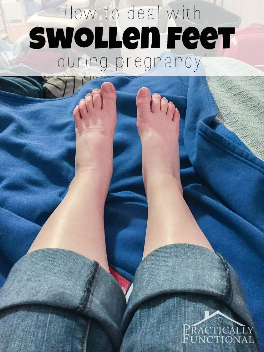 What can i do for swollen ankles during pregnancy ...