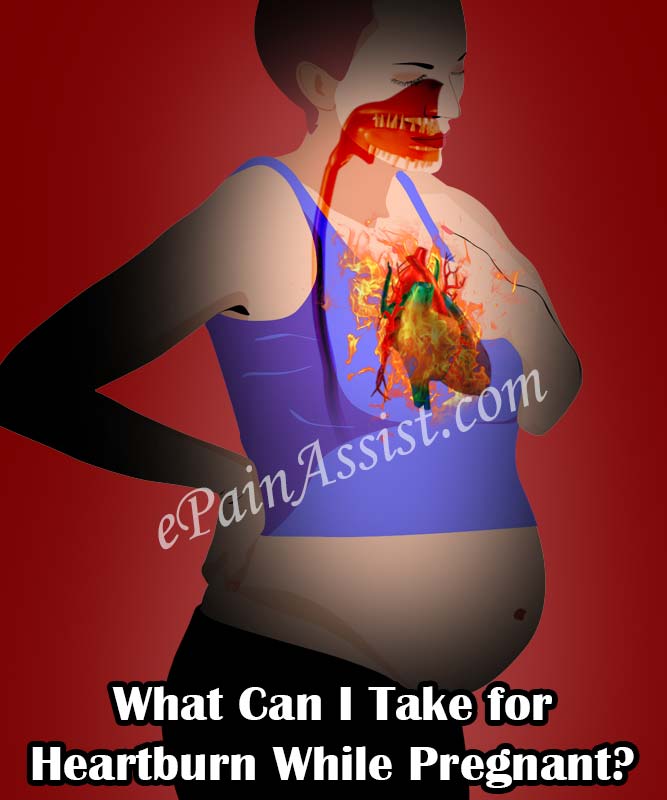 What Can I Take for Heartburn While Pregnant?