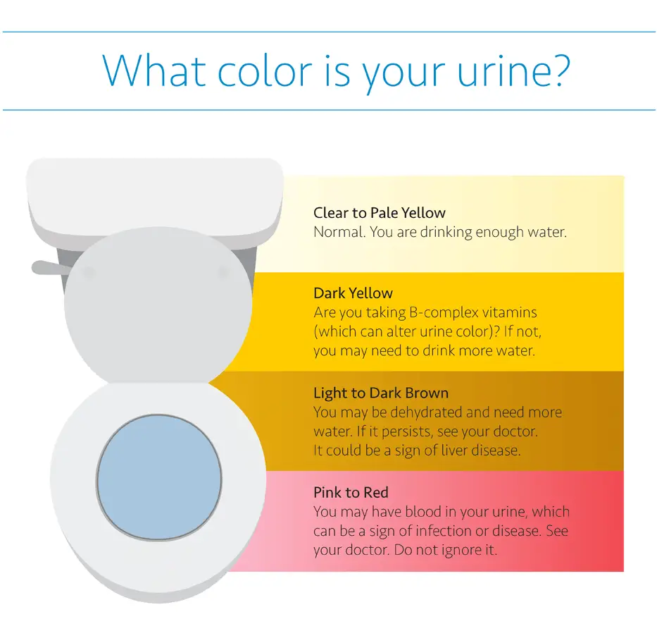 What color is your urine?