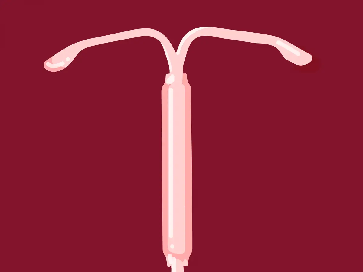 What Happens After You Get Your IUD Out?