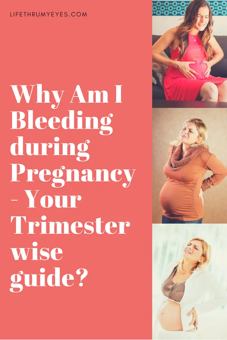 Why Am I Bleeding During Pregnancy
