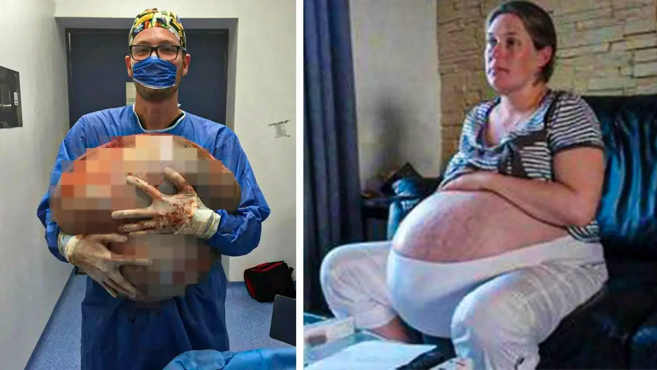 Woman looks like shes pregnant with 10 children Then she ...
